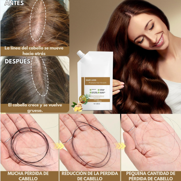 Anti-Hair Fall Shampoo - Anti-Caída y Reactivación Capilar
